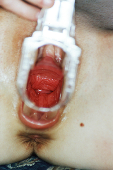 gallery-thumbnail