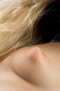 gallery-thumbnail