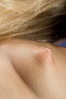 gallery-thumbnail