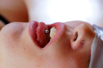 gallery-thumbnail