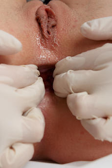 gallery-thumbnail